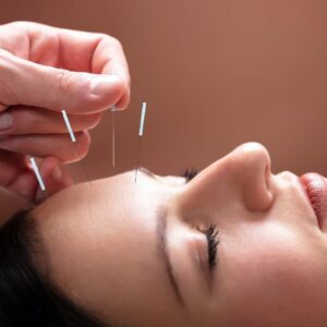 Acupuntura Araxá WhatsApp