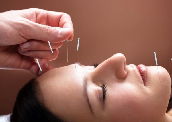 Acupuntura Araxá WhatsApp